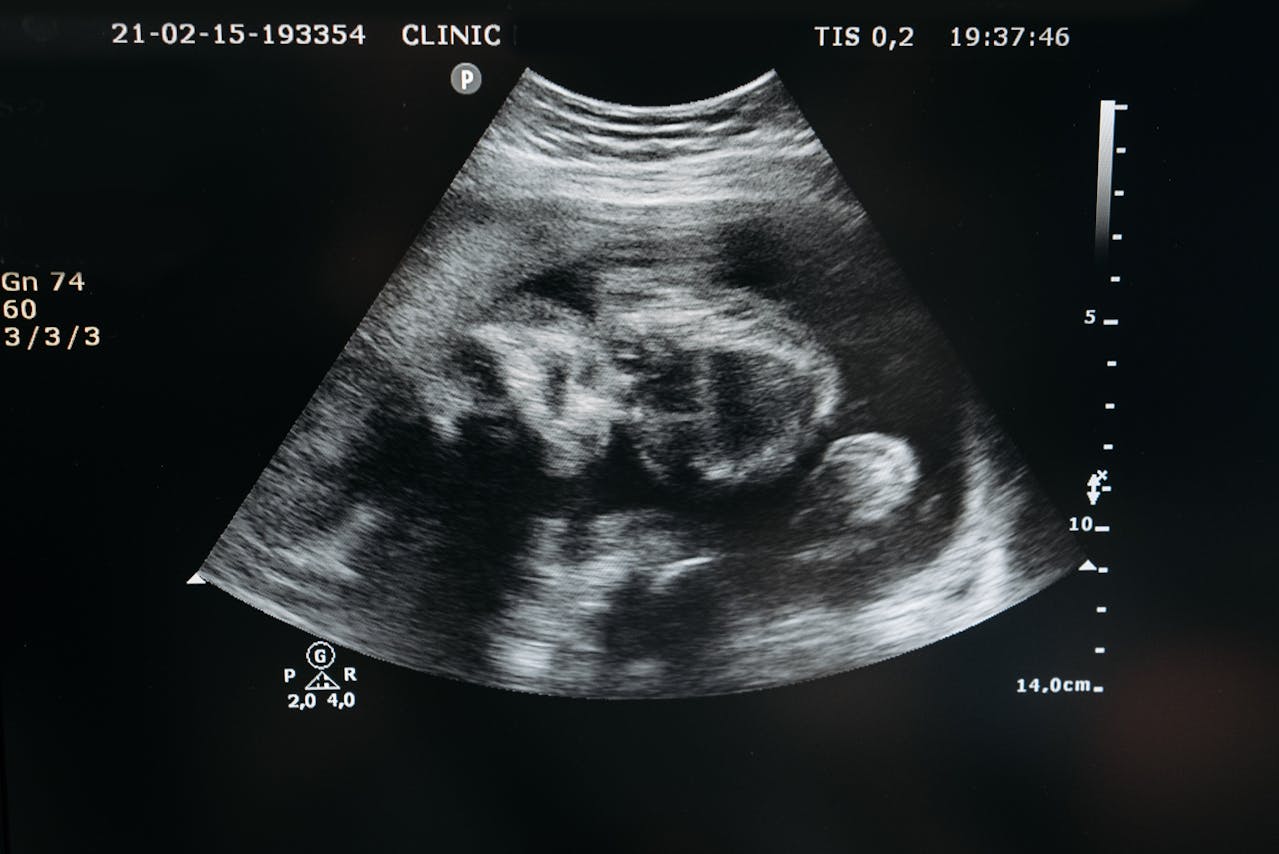 contra-aborto,-porto-rico-passa-a-reconhecer-feto-como-pessoa-natural-desde-a-concepcao